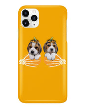 Load image into Gallery viewer, Beagle Hand Bones My Breast Gift For Dog Lovers Phone case
