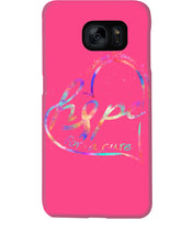 Load image into Gallery viewer, Hope For A Cure Multiple Sclerosis Awareness Phone case