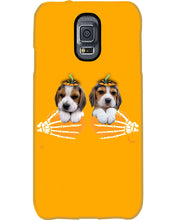 Load image into Gallery viewer, Beagle Hand Bones My Breast Gift For Dog Lovers Phone case