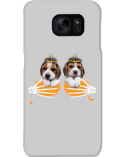 Load image into Gallery viewer, Beagle Hand Bones My Breast Gift For Dog Lovers Phone case