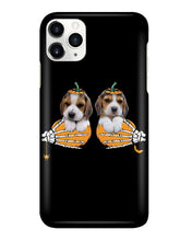 Load image into Gallery viewer, Beagle Hand Bones My Breast Gift For Dog Lovers Phone case