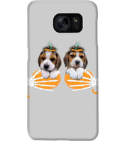 Load image into Gallery viewer, Beagle Hand Bones My Breast Gift For Dog Lovers Phone case
