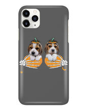 Load image into Gallery viewer, Beagle Hand Bones My Breast Gift For Dog Lovers Phone case
