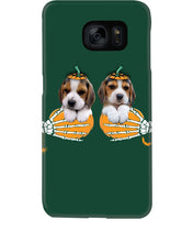 Load image into Gallery viewer, Beagle Hand Bones My Breast Gift For Dog Lovers Phone case
