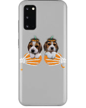 Load image into Gallery viewer, Beagle Hand Bones My Breast Gift For Dog Lovers Phone case
