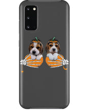 Load image into Gallery viewer, Beagle Hand Bones My Breast Gift For Dog Lovers Phone case
