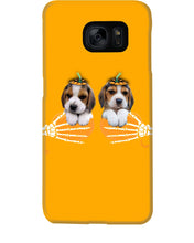 Load image into Gallery viewer, Beagle Hand Bones My Breast Gift For Dog Lovers Phone case
