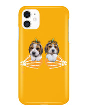 Load image into Gallery viewer, Beagle Hand Bones My Breast Gift For Dog Lovers Phone case
